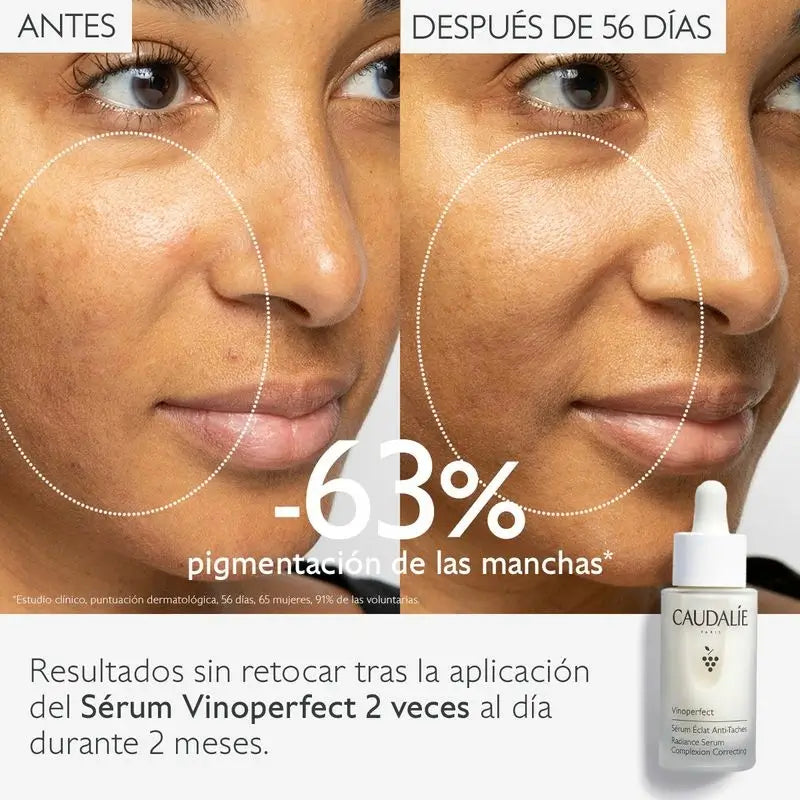 Caudalie Vinoperfect Serum Resplandor Antimanchas 30 ml