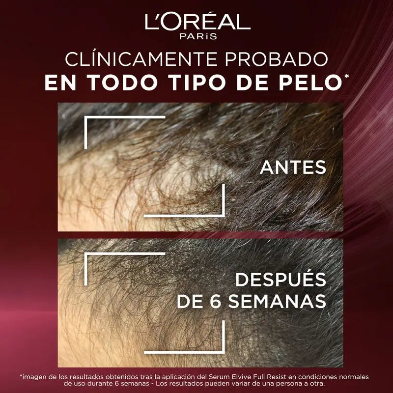 L'Oréal Paris Elvive Full Resist Anti-Hair Loss Serum: With 1.5% Aminexil, Caffeine & Arginine, Strengthens & Reduces Hair Loss